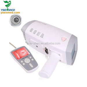 YSPL9800B, портативный мини-кольпоскоп для гинекологии - Product Image 3