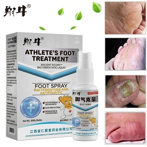 Spray antifongique pour les pieds à base de plantes pour athlètes adultes, marque OEM, dermatophytose, démangeaisons des pieds - Product Image 4