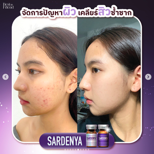 Mascarilla Facial Rejuvenecedora de la Piel <span class=keywords><strong>Sardenya</strong></span> Skin Booster Exoprime de Corea, 3 Sets, Hidratante, Antiarrugas, Antiedema, para Cicatrices de Acné y Piel Seca - Product Image 5