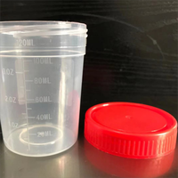 Contenedor de recolección de muestras de orina médica de hospital Contenedor de orina estéril desechable 120ml 250ml