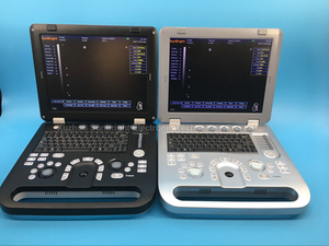 Ecógrafo Digital Portátil de 15 Pulgadas, Ecógrafo 2D 3D 4D en Blanco y Negro para Uso Hospitalario - Product Image 5