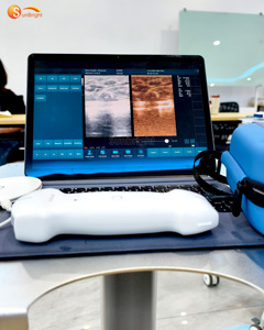 Di động cầm tay không dây siêu âm 3 trong 1 siêu âm DOPPLER màu Wifi đầu dò máy siêu âm - Product Image 3