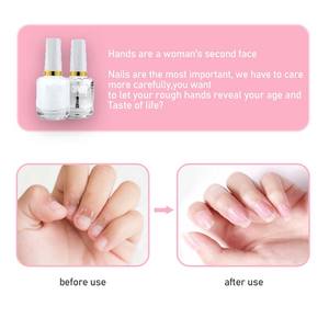 CHAORY GEL <span class=keywords><strong>Esmalte</strong></span> de <span class=keywords><strong>uñas</strong></span> Suavizante de piel muerta Más aceite base de <span class=keywords><strong>calcio</strong></span> Aceite brillante Aceite nutricional - Product Image 5