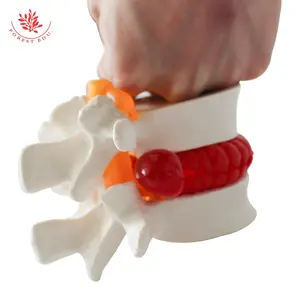 Modelo de columna vertebral de ciencia médica FRT039, hernia de disco lumbar clínico, modelo de anatomía de rehabilitación de sangre para apretar vértebras