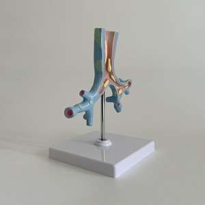 Modelo de Enseñanza Médica, Modelo de Anatomía Patológica de las Bronquias para la Educación en Medicina Respiratoria y Pulmonología - Product Image 4