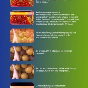 Máquina Reductora de Grasa Abdominal, Equipo Deportivo para Quemar Grasa, Dispositivo para Reducir Grasa Abdominal - Product Image 4