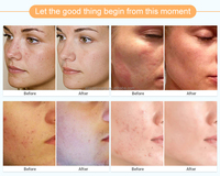 Nouveau Type masque de boue pour le visage extrait de plante bio nettoyage en profondeur contrôle de l'huile Salon hydratant raffermissant traitement de l'acné pour unisexe