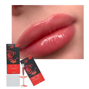 Relleno <span class=keywords><strong>de</strong></span> <span class=keywords><strong>Labios</strong></span> Antiarrugas <span class=keywords><strong>de</strong></span> Alta Calidad con Ácido Hialurónico y Vitamina B12 para <span class=keywords><strong>Labios</strong></span> Naturales, Suaves y Voluminosos, Relleno <span class=keywords><strong>de</strong></span> <span class=keywords><strong>Labios</strong></span> Rojos - Product Image 2