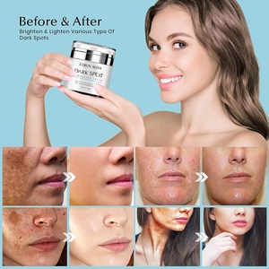 ETRUN ALISA Marque privée Crème correctrice contre les taches brunes Hydratant infusé à la <span class=keywords><strong>grenade</strong></span> Calme Éclaircit le teint Favorise la peau - Product Image 3