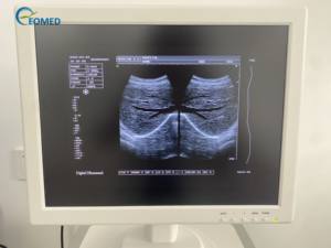 Mesin <span class=keywords><strong>Ultrasound</strong></span> portabel Trolley B/W mesin <span class=keywords><strong>Ultrasound</strong></span> untuk <span class=keywords><strong>Vet</strong></span> dan manusia BW1100 - Product Image 6