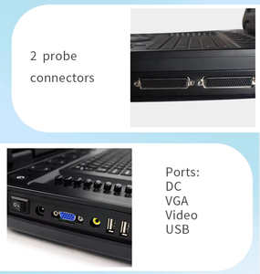 เครื่องอัลตราซาวนด์วัวแบบพกพาสำหรับสัตวแพทย์ รุ่น VDL151A Periodmed เครื่องอัลตราซาวนด์วัวสำหรับสัตวแพทย์ VDL151A VDL151A - Product Image 5