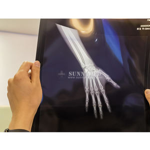 جهاز أشعة سينية بيطرية رقمي محمول ، جهاز أشعة سينية رقمي DR <span class=keywords><strong>X</strong></span> راي صغير بيطري ، عيادة الحيوانات الأليفة - Product Image 3