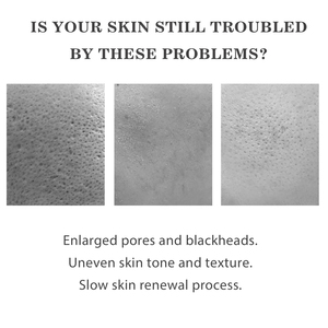 Vente en gros Effet rapide <span class=keywords><strong>2</strong></span>% <span class=keywords><strong>BHA</strong></span> Liquide Exfoliant <span class=keywords><strong>Bha</strong></span> <span class=keywords><strong>Lotion</strong></span> pour le Visage Sérum Blanchissant pour le Visage - Product Image 2