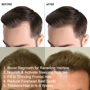 Sérum Huile Capillaire Oalen à la Biotine pour la Croissance des <span class=keywords><strong>Cheveux</strong></span> et Traitement Anti-Chute, pour des <span class=keywords><strong>Cheveux</strong></span> Plus Épais et une <span class=keywords><strong>Repousse</strong></span> Rapide de la Barbe - Product Image 4