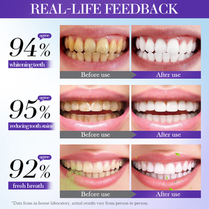OEM Sadoer Venta al por mayor <span class=keywords><strong>V34</strong></span> Dientes Blanqueamiento Pasta de dientes Mousse Uso en el hogar Cuidado bucal Removedor de blanqueamiento con eliminación de manchas moradas - Product Image 4