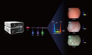 550s Sub GI Endoscopio veterinario Gastroenteroscopio y <span class=keywords><strong>enteroscopio</strong></span> - Product Image 3