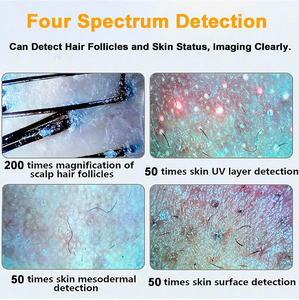 Nouvelle Caméra d'Analyse Corporelle et du Cuir Chevelu 3D 2025 à Succès Commercial en Ligne avec 2 Détecteurs, Prise EU, pour Salons de Beauté - Product Image 4