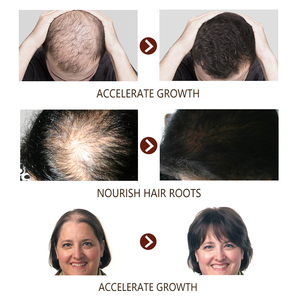 <span class=keywords><strong>Sérum</strong></span> d'huile de croissance des <span class=keywords><strong>cheveux</strong></span> à l'huile de gingembre - Product Image 6