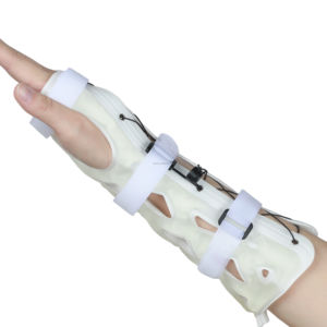 <span class=keywords><strong>Attelle</strong></span> médicale pour main et <span class=keywords><strong>poignet</strong></span>, immobilisateur de main et de <span class=keywords><strong>poignet</strong></span> à durcissement à la lumière - Product Image 5