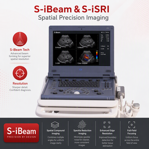 Dispositivo de Imagenología Clínica Digital Profesional, Sistema de Ultrasonido Doppler a Color Portátil tipo Laptop C6pro-02 Advanced Trueview - Product Image 3
