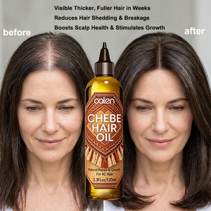Crecimiento Rápido en 7 Días, Aceite Capilar de Manteca de Chebe Africana de Marca Privada Oalen Luxfume, Productos <span class=keywords><strong>para</strong></span> el Crecimiento <span class=keywords><strong>del</strong></span> Cabello con Aceite de Chebe, Anticaída - Product Image 2