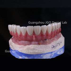 Implant <span class=keywords><strong>dentaire</strong></span> Toutes les couronnes et ponts dentaires <span class=keywords><strong>en</strong></span> céramique avec un <span class=keywords><strong>prix</strong></span> compétitif esthétique élevé - Product Image 5