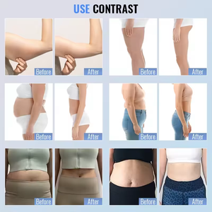 Dispositivo Profesional de Vibración para Quemar Grasa, el Mejor Masajeador Anticelulítico con Rodillos de Vacío para Moldear el Cuerpo - Product Image 6
