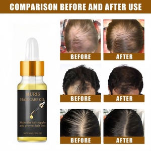 L'huile de noix de coco aide à prévenir la perte rend les <span class=keywords><strong>cheveux</strong></span> lisses nourrit les follicules renforce rend lisse prévenir les frisottis - Product Image 4