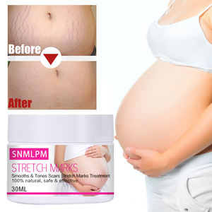SNMLPM Estrías 100% <span class=keywords><strong>Las</strong></span> estrías naturales <span class=keywords><strong>se</strong></span> desvanecen <span class=keywords><strong>Se</strong></span> <span class=keywords><strong>pueden</strong></span> usar para el estómago, <span class=keywords><strong>las</strong></span> piernas, el pecho, <span class=keywords><strong>las</strong></span> nalgas 30ml - Product Image 5