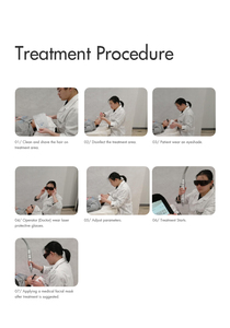 Macchina Laser Nd Yag Q-Switched con Uscita Stabile e Prolungata per Rimozione Professionale dei Tatuaggi - Product Image 4