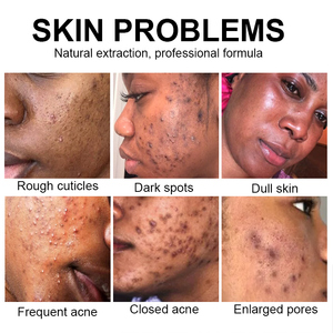 ชุดผลิตภัณฑ์ดูแลผิวหน้าออร์แกนิคจากข<span class=keywords><strong>ม</strong></span>ิ้นธรร<span class=keywords><strong>ม</strong></span>ชาติ ช่วย<span class=keywords><strong>ลด</strong></span>เลือนริ้วรอย ฟื้นฟูผิวกระจ่างใส <span class=keywords><strong>ลด</strong></span>สิว และปรับผิวขาว (ให<span class=keywords><strong>ม</strong></span>่) <span class=keywords><strong>รีวิว</strong></span>ดีที่สุด - Product Image 2