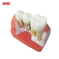 Dentiste dentaire Modèle de Dents De Démonstration D'implant L'analyse Couronne Pont bon