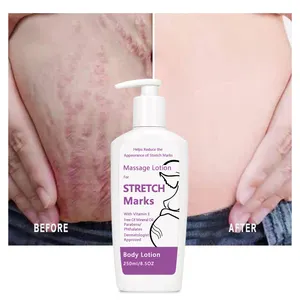 批发除疤霜有效的深部痤疮疤痕为腿部和大腿的女性妊娠纹霜套装 - Product Image 1