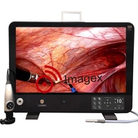 Système de caméra d'endoscopie tout-en-un avec source de lumière LED pour les cliniques médicales et vétérinaires
