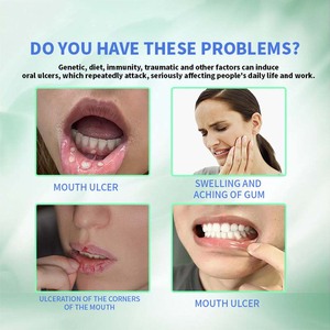 Enjuague Bucal para el Alivio de Úlceras Orales, Promueve la Reparación Mucosa, Reduce la Hinchazón, Acelera la Curación, Aliento Fresco, Uso Diario - Product Image 4
