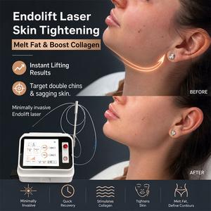 <span class=keywords><strong>Precio</strong></span> de Fábrica: Máquina L-SER para Endolifting con Fibra Óptica de 980nm y 1470nm para Lipólisis Facial y Cirugía de Endolifting - Product Image 4
