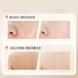 Jabón de Aceite Esencial de Sándalo 70g, Limpieza Profunda Natural, Eliminación de Ácaros, Fragancia Duradera, Aclara la Piel - Product Image 4