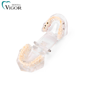 Modèle dentaire transparent pour l'enseignement de la pathologie dentaire avec dents amovibles pour la démonstration de prothèses - Product Image 5