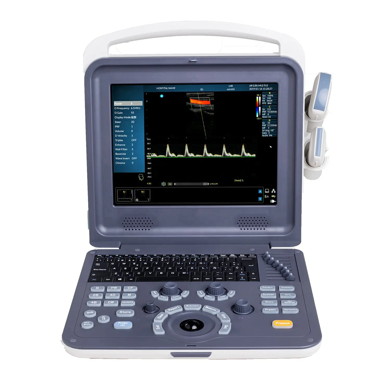 Portable Full Digital Diagnostic Color Doppler 2D Ultrasound Scanner System for hospital