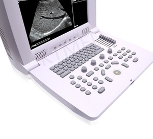 KT-A012 Portable Digital VET/human B/W Ultrasound Laptop Type Black and White Ultrasound Scanner Machine for <strong>Pregnancy</strong> - Product Image 4