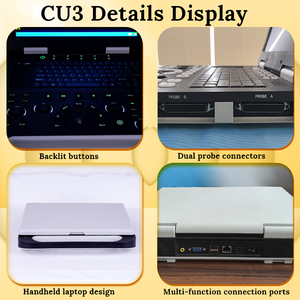 RS-CU5 Doppler warna 3D dokter hewan resolusi tinggi 15 inci hitam portabel PW CW gema Digital penuh ginekologi Ultrasound - Product Image 2