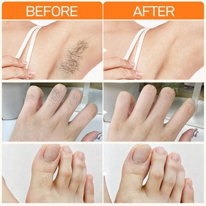 Crème dépilatoire rapide JoyPretty pour femmes, crème dépilatoire pour les parties intimes des femmes, crème dépilatoire ciblée pour le visage - Product Image 4