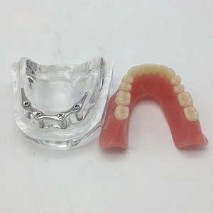 Modelo de cirugía dental y oral para nuevos productos de ciencia médica de implantación y Prostodoncia - Product Image 6