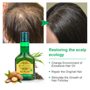 MOKERU Kem Dưỡng Mọc Tóc Cho Nam Tinh Dầu Neo Hữu Cơ Dầu Bổ Dưỡng Tóc Công Thức Tăng Trưởng Từ Thái Lan - Product Image 4