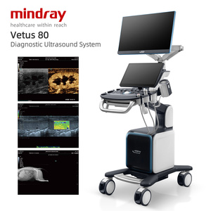 Système d'imagerie diagnostique portable entièrement numérique Mindray Vetus 80, échographe pour usage vétérinaire avec sonde convexe - Product Image 2