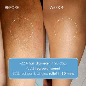 <span class=keywords><strong>Lotion</strong></span> Corporelle Apaisante et Hydratante Naturelle Sous Marque Blanche pour Peaux Irritées, Anti-Poils Incarnés, Soin Corporel Inhibiteur de Croissance des Poils pour Peaux Sensibles - Product Image 6