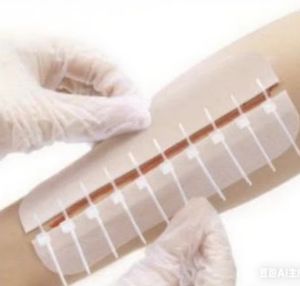 Pansement adhésif stérile en forme de papillon découpable Master 60mmx195mm pour la fermeture des plaies, 10 pièces, utilisation d'urgence, certifié CE Classe II - Product Image 1