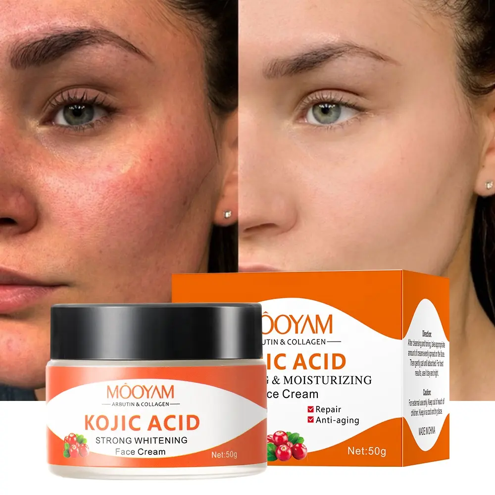 Private Label Hautpflege Gesichts creme Koji säure Kollagen Gesichts aufhellung creme Haut aufhellung creme für schwarze Haut