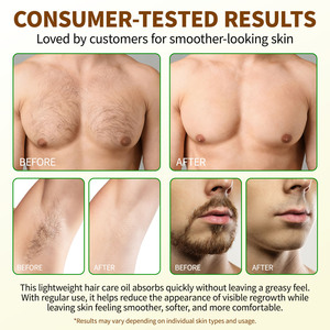 Huile pure de Cyperus Rotundus Uocasi, inhibiteur naturel pour réduire la croissance indésirable des poils, huile de Cyperus Rotundus pour la réduction des poils - Product Image 4