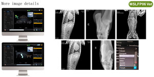 Iray 17*17 Wireless <span class=keywords><strong>DR</strong></span> X Ray rilevatore a schermo piatto per la radiografia digitale - Product Image 3